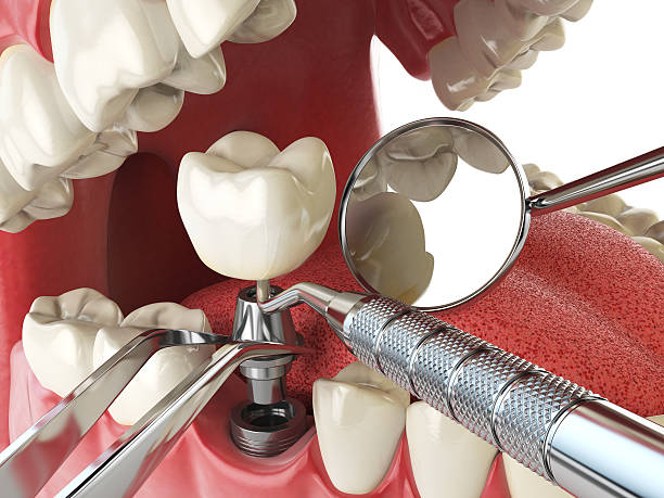 Best Emergency Orthodontic Repairs in Commerce, CA